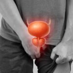 Ghanaian Men Urged to Check Prostate Regularly as Cancer Can Remain Hidden for Years