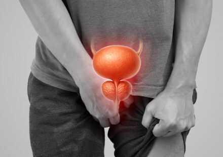 Ghanaian Men Urged to Check Prostate Regularly as Cancer Can Remain Hidden for Years