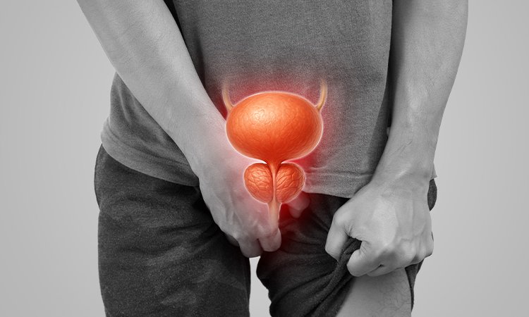 Ghanaian Men Urged to Check Prostate Regularly as Cancer Can Remain Hidden for Years
